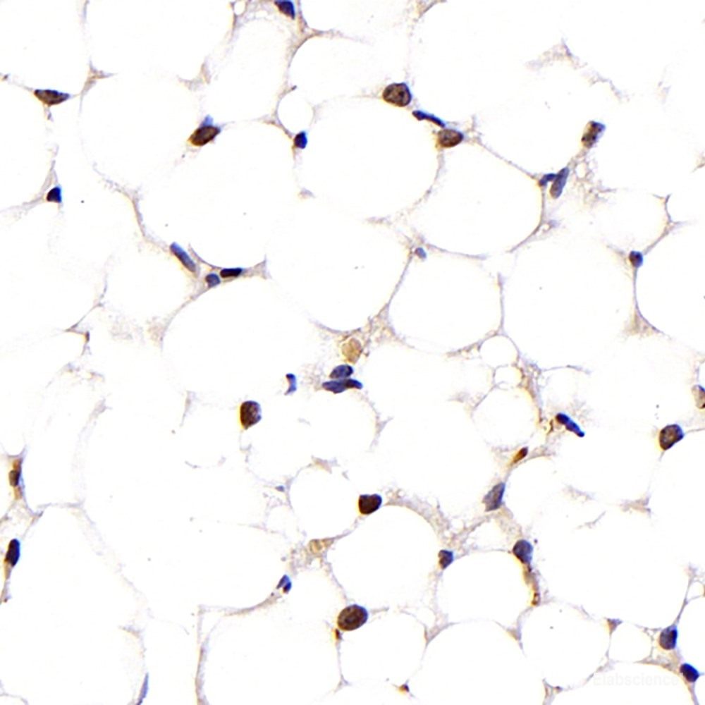 Immunohistochemistry of paraffin-embedded Rat brain using IGF1 Polyclonal Antibody at dilution of  1:100 (40x lens).