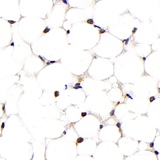 Immunohistochemistry of paraffin-embedded Rat brain using IGF1 Polyclonal Antibody at dilution of  1:100 (40x lens).