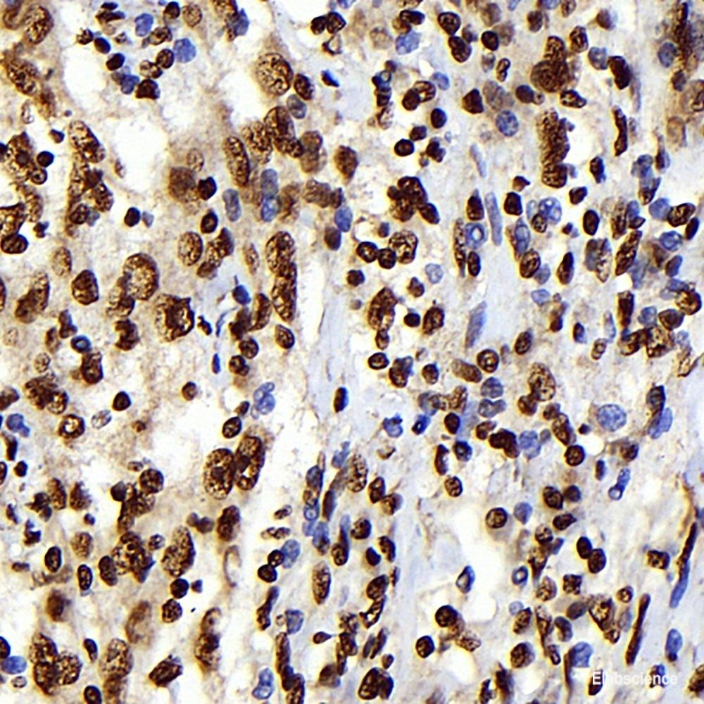 Immunohistochemistry of paraffin-embedded Human prostate using APOE Polyclonal Antibody at dilution of  1:100 (40x lens).