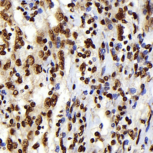 Immunohistochemistry of paraffin-embedded Human prostate using APOE Polyclonal Antibody at dilution of  1:100 (40x lens).