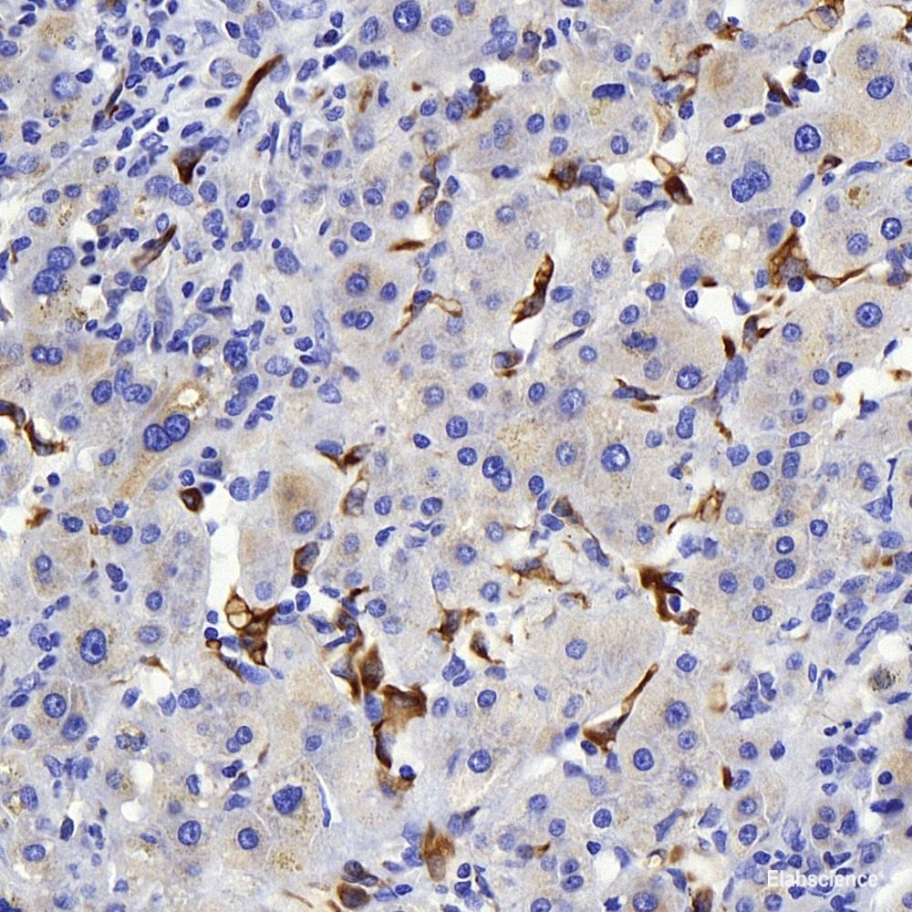Immunohistochemistry of paraffin-embedded Human uterus using PGR Polyclonal Antibody at dilution of  1:100 (40x lens).