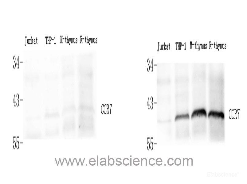Immunohistochemistry of paraffin-embedded Human tonsil using CD44 Polyclonal Antibody at dilution of  1:200 (40x lens).