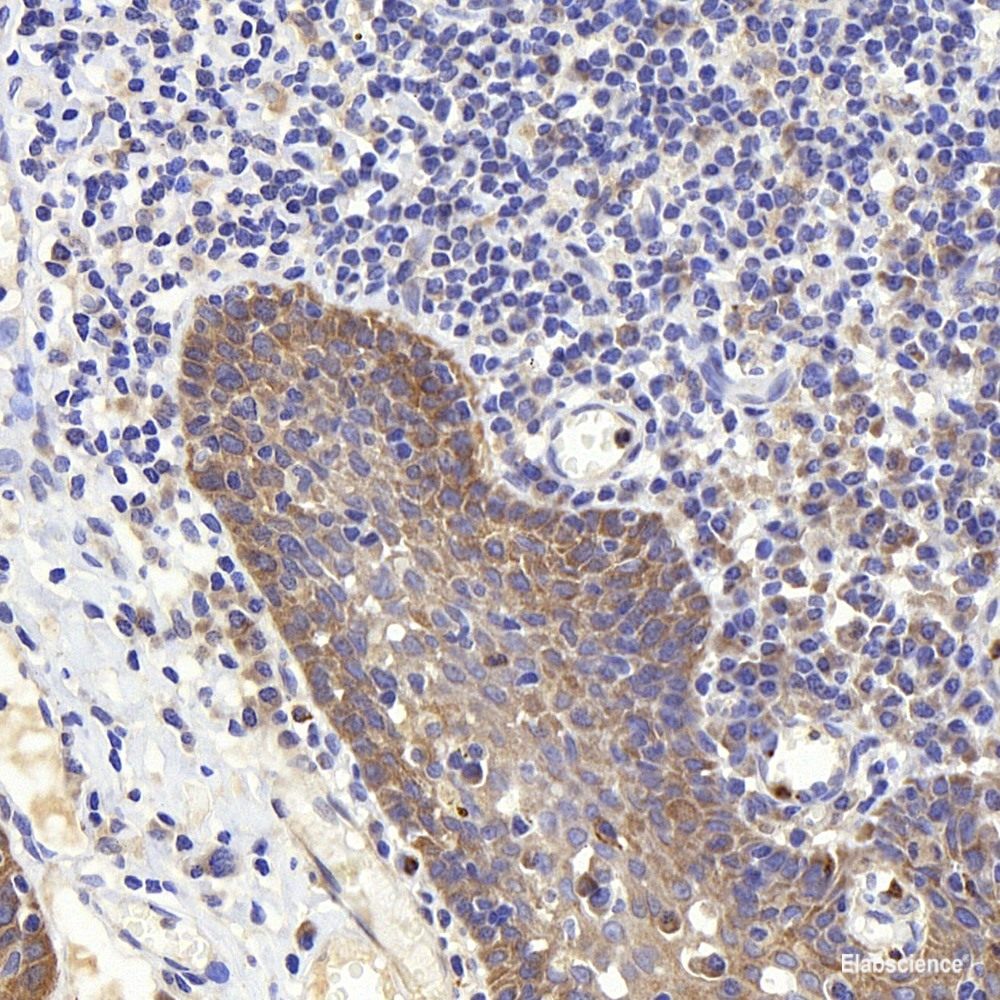 Immunohistochemistry of paraffin-embedded Human colon using CDK4 Polyclonal Antibody at dilution of  1:100 (40x lens).