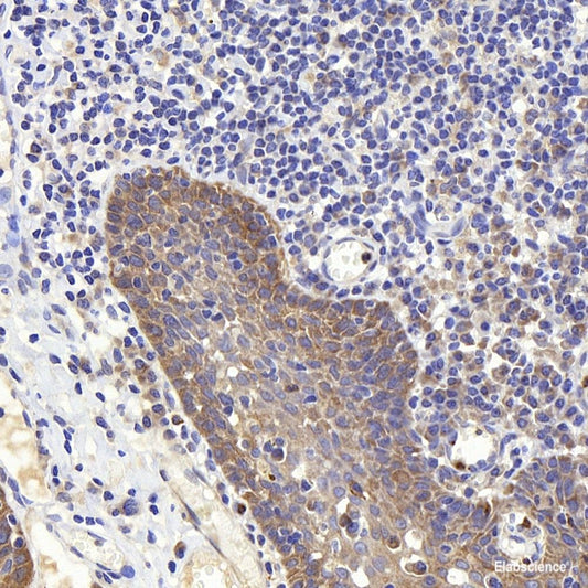 Immunohistochemistry of paraffin-embedded Human colon using CDK4 Polyclonal Antibody at dilution of  1:100 (40x lens).