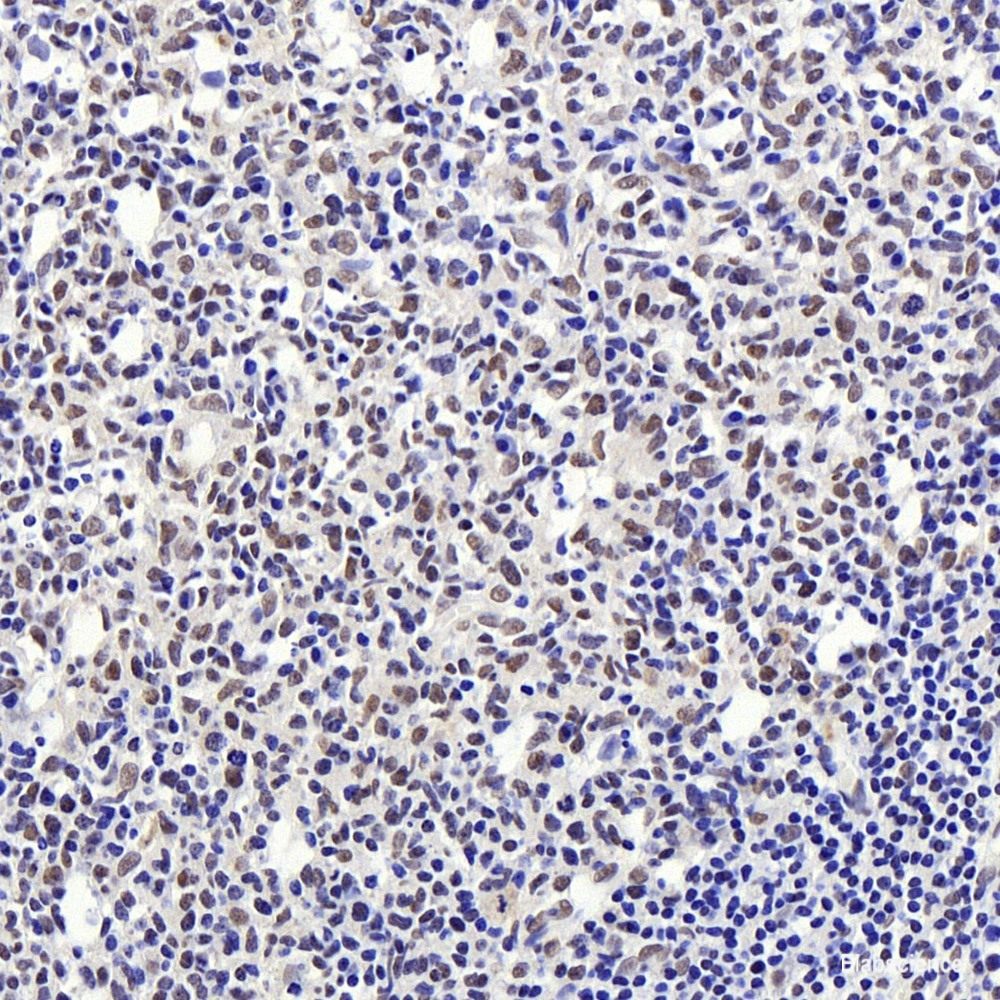Immunohistochemistry of paraffin-embedded Rat ovary using VHL Polyclonal Antibody at dilution of  1:200 (40x lens).