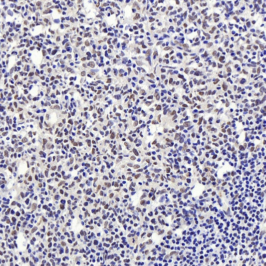Immunohistochemistry of paraffin-embedded Rat ovary using VHL Polyclonal Antibody at dilution of  1:200 (40x lens).