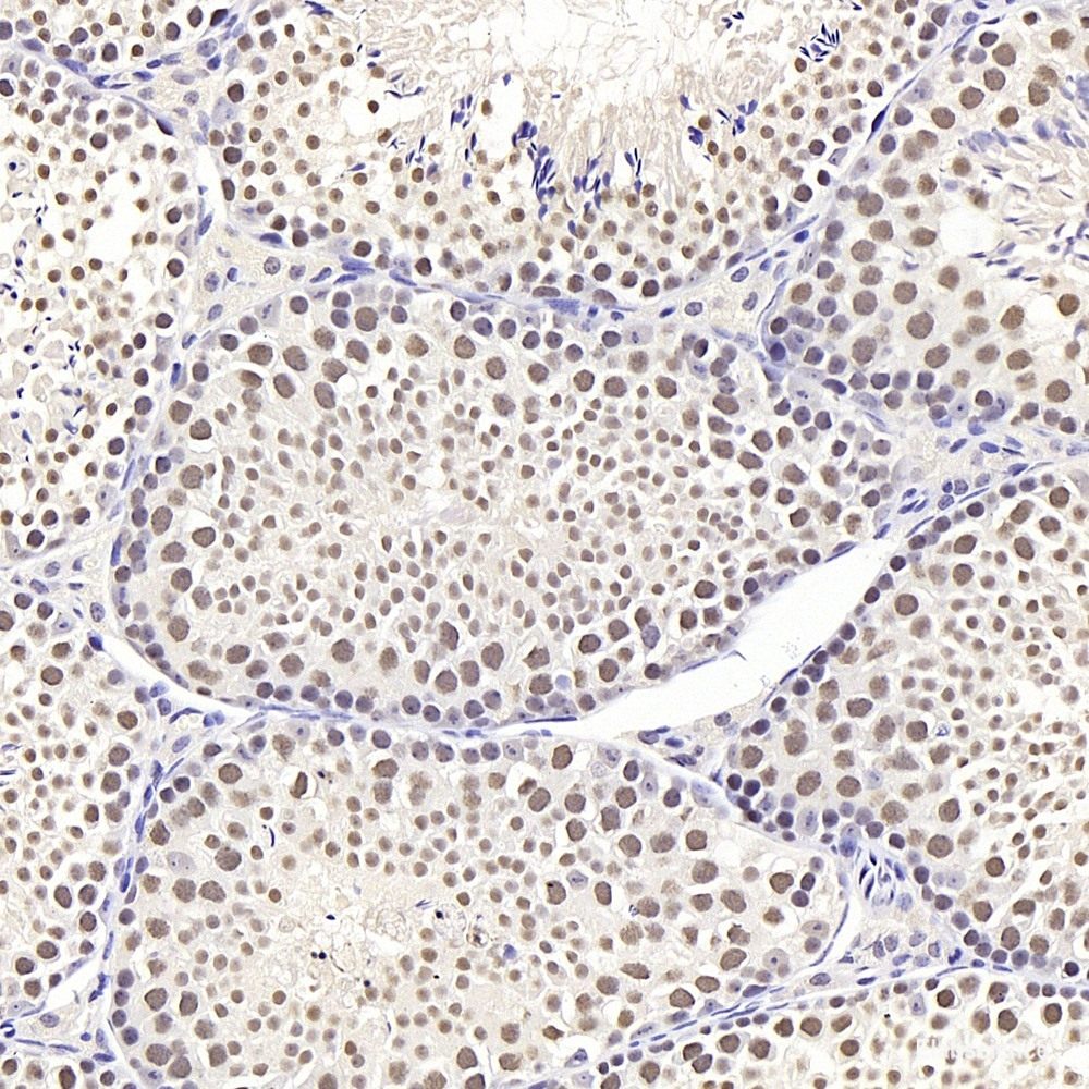 Immunohistochemistry of paraffin-embedded Rat heart using N-Cadherin Polyclonal Antibody at dilution of  1:100 (40x lens).