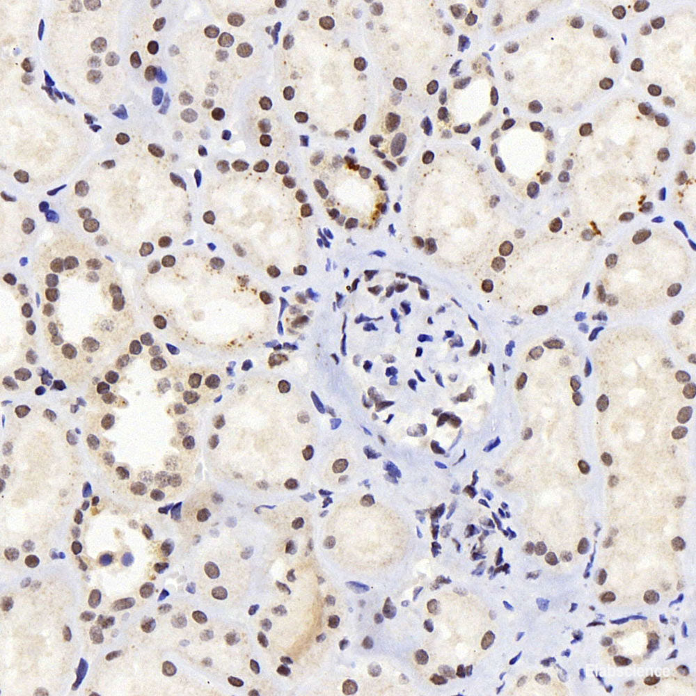 Immunohistochemistry of paraffin-embedded Mouse liver using N-Cadherin Polyclonal Antibody at dilution of  1:100 (40x lens).