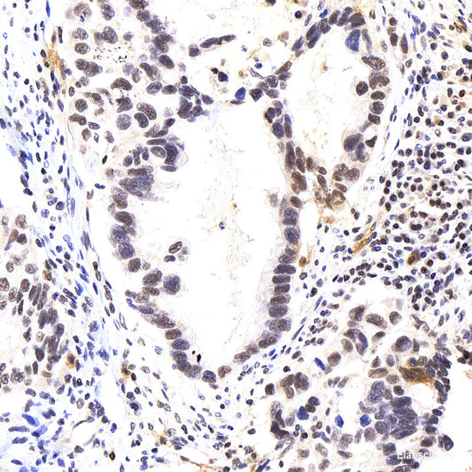 Immunofluorescence analysis of HeLa cells using XRCC1 Polyclonal Antibody at dilution of  1:100 (40x lens). Blue: DAPI for nuclear staining.