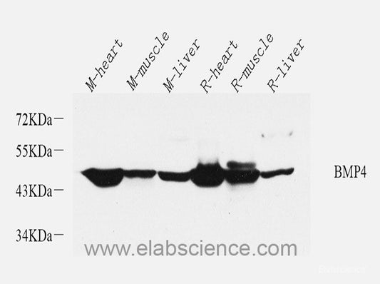 Immunohistochemistry of paraffin-embedded Rat brain using TSC2 Polyclonal Antibody at dilution of  1:200 (40x lens).