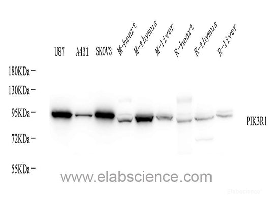 Immunohistochemistry of paraffin-embedded Mouse brain using MYCN Polyclonal Antibody 