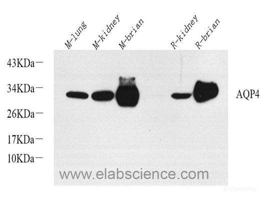 Western blot analysis of extracts of various cell lines using RIG-I / DDX58 Polyclonal Antibody at dilution of 1:500.