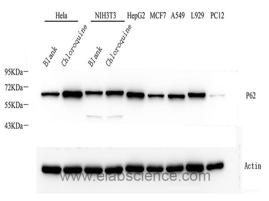 Immunohistochemistry of paraffin-embedded Human prostate using NEDD4 Polyclonal Antibody at dilution of  1:200 (40x lens).