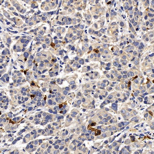 Immunohistochemistry of paraffin-embedded Rat kidney using HSPA9 Polyclonal Antibody at dilution of  1:100 (40x lens).