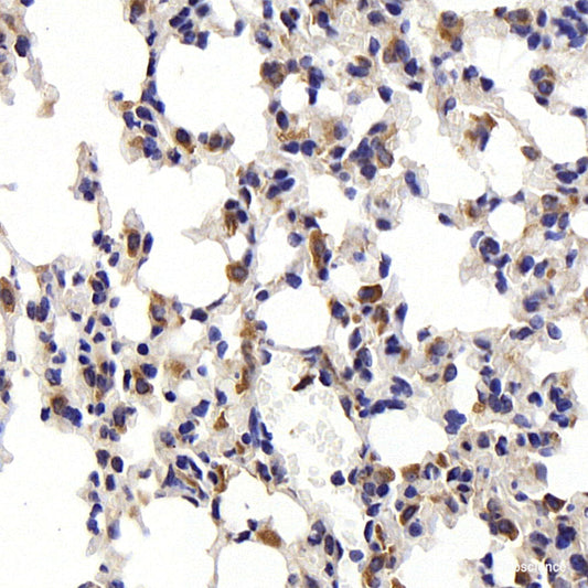 Immunohistochemistry of paraffin-embedded Human stomach using NOTCH2 Polyclonal Antibody at dilution of  1:100 (40x lens).