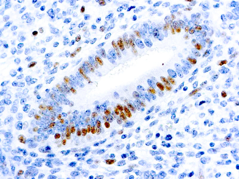 E2F-1 Transcription Factor