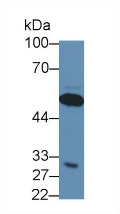 Monoclonal Antibody to Pepsinogen A (PGA)