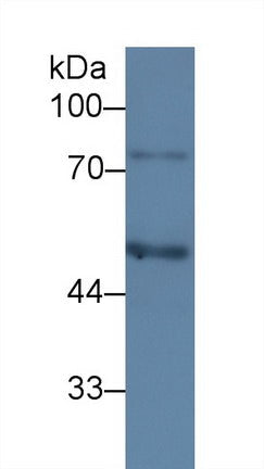 Monoclonal Antibody to Complement 1 Inhibitor (C1INH)