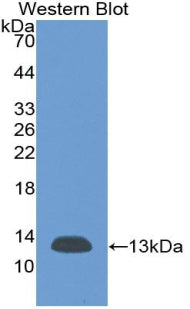 Monoclonal Antibody to Beta-2-Microglobulin (b2M)