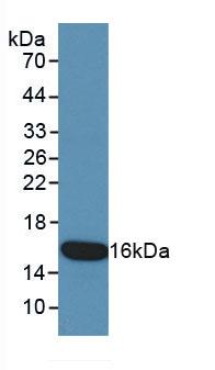 Monoclonal Antibody to Cytokeratin 15 (CK15)