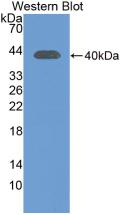 Monoclonal Antibody to Insulin Receptor (INSR)