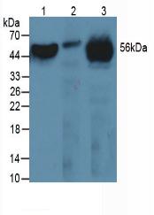 Monoclonal Antibody to Fibrinogen Beta Chain (FGB)