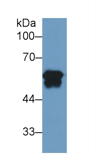 Monoclonal Antibody to Fibrinogen Beta Chain (FGB)