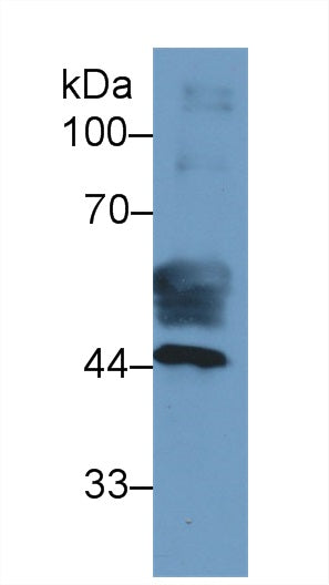 Monoclonal Antibody to Heart-type Fatty Acid Binding Protein (H-FABP)