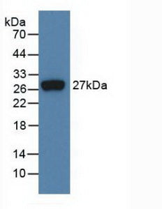 Monoclonal Antibody to Fibroblast Growth Factor 21 (FGF21)