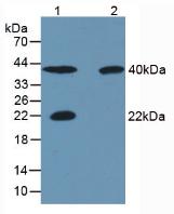 Monoclonal Antibody to Carbonic Anhydrase III, Muscle Specific (CA3)