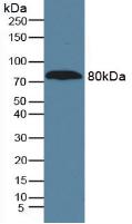 Monoclonal Antibody to Alpha-1-B-Glycoprotein (a1BG)
