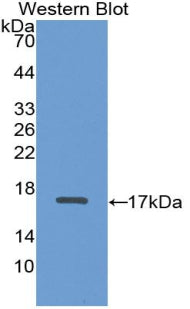 Monoclonal Antibody to A Disintegrin And Metalloproteinase With Thrombospondin 2 (ADAMTS2)