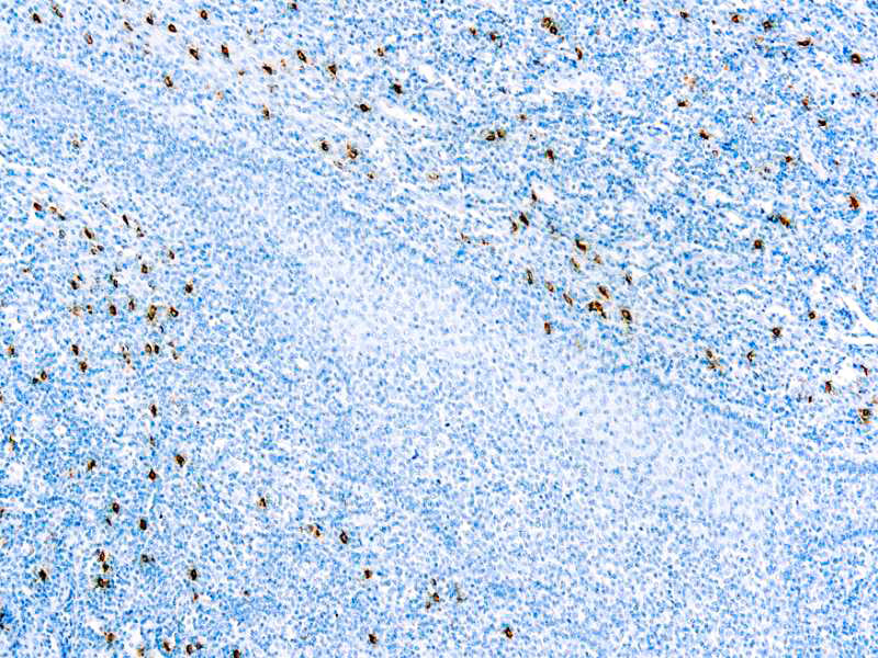 Mast Cell Tryptase