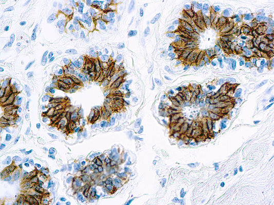 Epithelial Antigen
