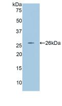 Polyclonal Antibody to Angiopoietin 2 (ANGPT2)
