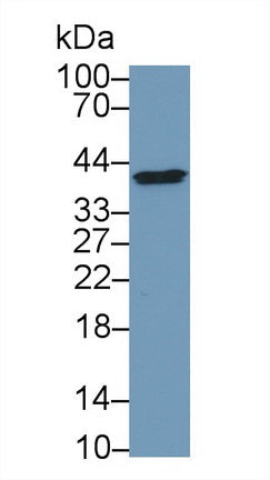 Polyclonal Antibody to Factor Related Apoptosis (FAS)