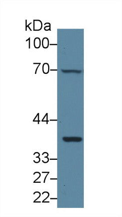 Polyclonal Antibody to Glycoprotein 130 (gp130)