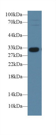 Polyclonal Antibody to Insulin Like Growth Factor Binding Protein 1 (IGFBP1)