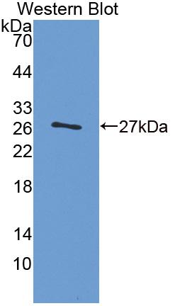 Polyclonal Antibody to Glial Fibrillary Acidic Protein (GFAP)