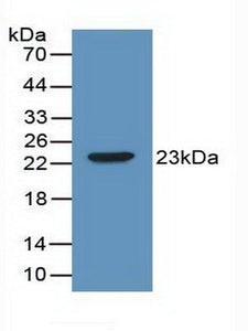 Polyclonal Antibody to Interleukin 2 (IL2)