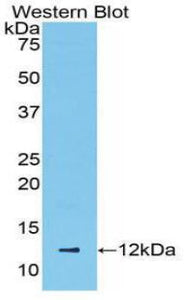 Polyclonal Antibody to Regulated On Activation In Normal T-Cell Expressed And Secreted (RANTES)