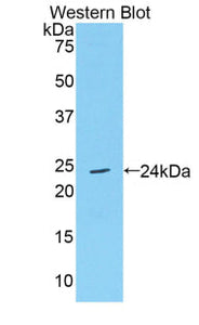 Polyclonal Antibody to Tissue Inhibitors Of Metalloproteinase 4 (TIMP4)