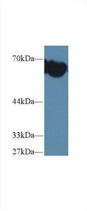 Polyclonal Antibody to Alpha-Fetoprotein (AFP)
