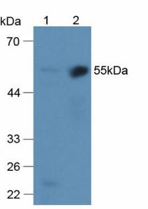Polyclonal Antibody to Alpha 2-Antiplasmin (a2PI)