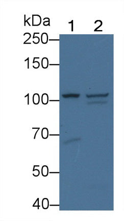 Polyclonal Antibody to Glucosidase Alpha, Acid (GaA)