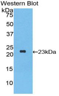 Polyclonal Antibody to Interferon Alpha 2 (IFNa2)