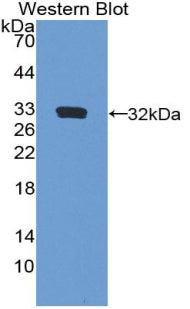 Polyclonal Antibody to Fibrillin 3 (FBN3)