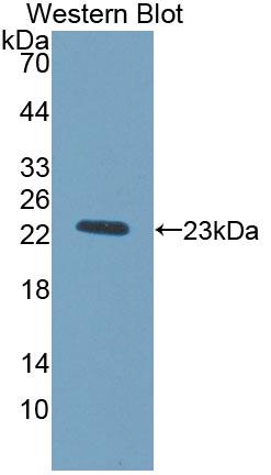Polyclonal Antibody to Tissue Inhibitors Of Metalloproteinase 1 (TIMP1)