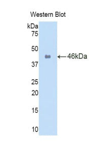Polyclonal Antibody to Interleukin 1 Beta (IL1b)