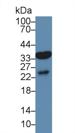 Polyclonal Antibody to Aquaporin 9 (AQP9)